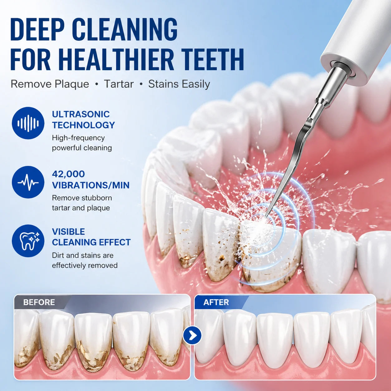 Ultrasonic Dental Scaler Electric Teeth Cleaner Sonic Teeth Plaque Cleaner Dental Stone Removal For Tartar Stain Cleaning Tools Zpaxo
