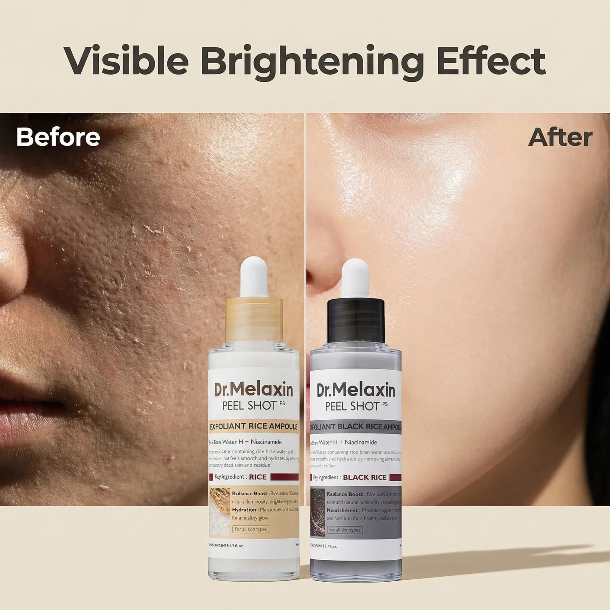 Black Rice Exfoliating Ampoule 80ml – AHA BHA Niacinamide Serum Exfoliating Face Serum Zpaxo United States 80ml