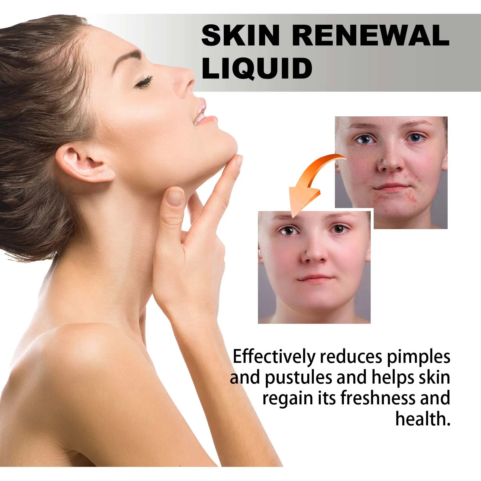 2% BHA Salicylic Acid Acne Serum – Pores, Dark Spots & Glow BHA Acne Serum Zpaxo