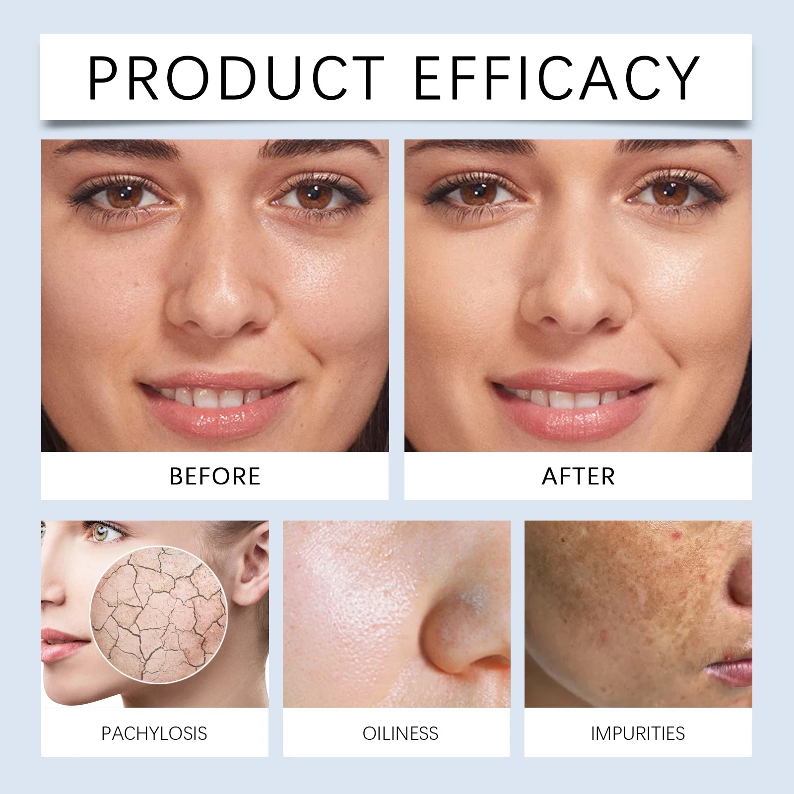 EELHOE Hyaluronic Acid Facial Mask Long-Lasting Facial Nourishmen Enhance Skin Elasticity Rich Moisture Gentle Formula 100g Zpaxo