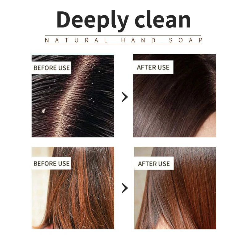 Tea tree essential oil plant shampoo is refreshing, oil controlling, dandruff reducing, and strong for hair. Handmade shampoo wi Zpaxo