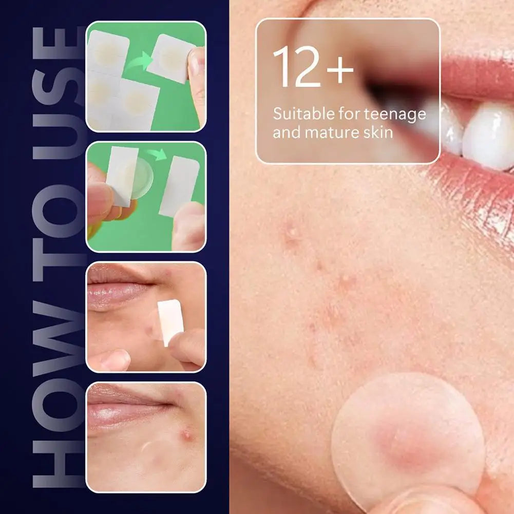 Hydrocolloid Pimple Patch Micro Needle Acne Patches Ultra-thin Invisible 8 Hours Effective Acne Cover Sticker Facial Care Tool Zpaxo
