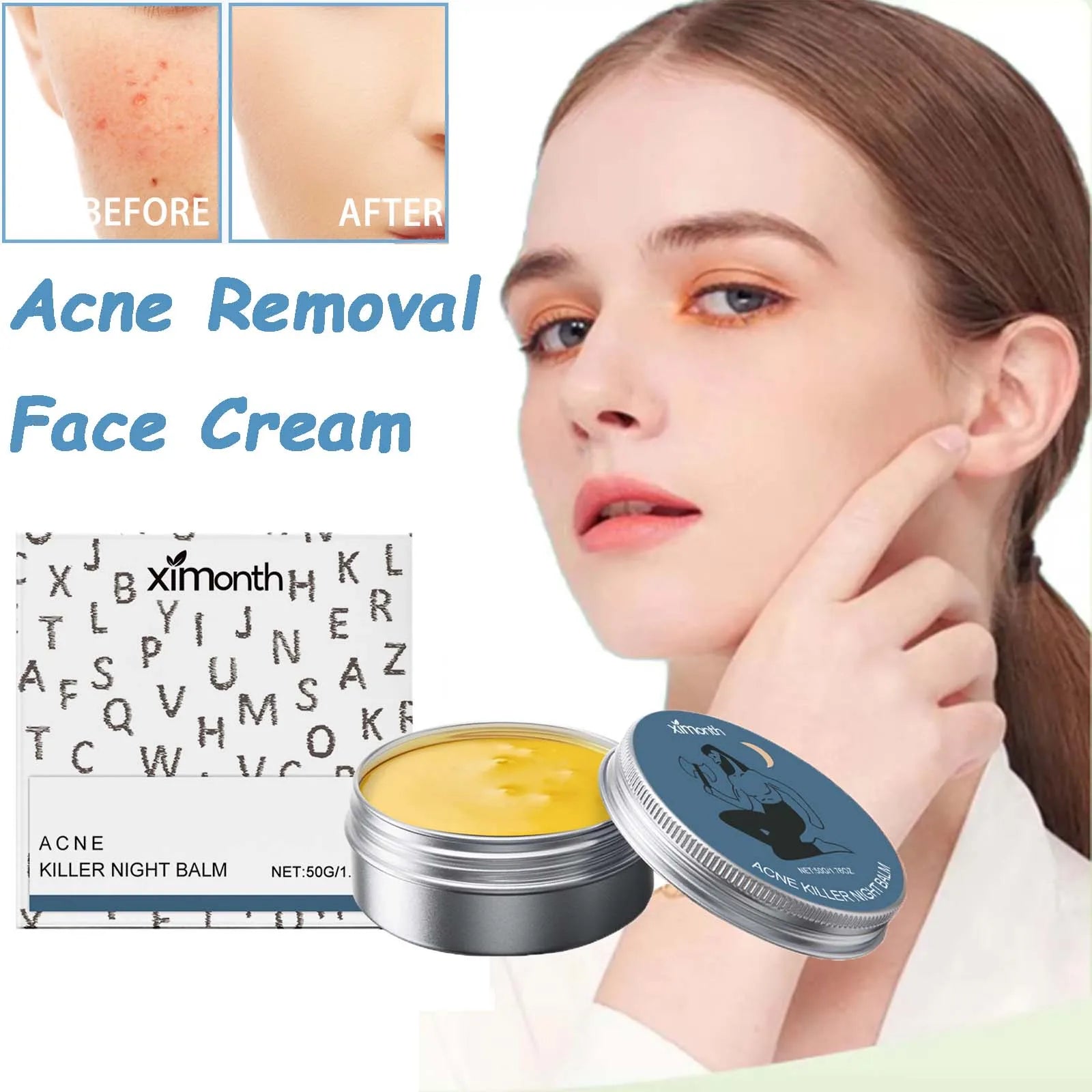 Ximonth Anti-Acne Face Cream – Oil Control & Pore Minimizing Anti-Acne Face Cream Zpaxo
