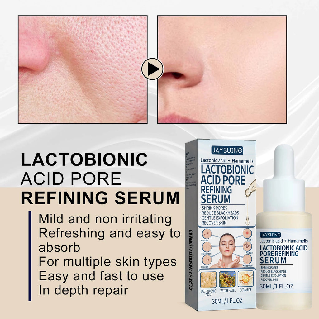 Lactic Acid Essence Removes Blackheads Tightens Pores Deep Cleansing Exfoliation Gently Moisturizes Skin Zpaxo