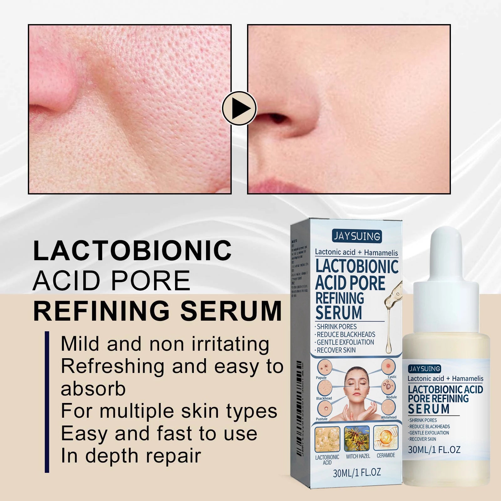 Lactic Acid Essence Removes Blackheads Tightens Pores Deep Cleansing Exfoliation Gently Moisturizes Skin Zpaxo