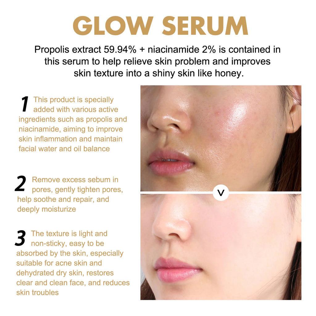 Glow Serum Propolis and Niacinamide Hydrating Facial Soothing Moisturizer Lighten Acne Marks Whitening Facial Essence Zpaxo