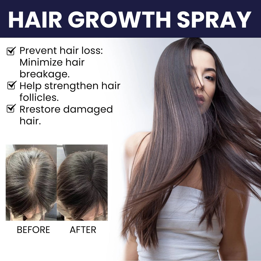 Ouhoe Hair Growth Spray Thinning Strengthen Roots Repair Dry Frizzy Collagen Formula No Residue 50ml Gentle for Sensitive Scalp Zpaxo