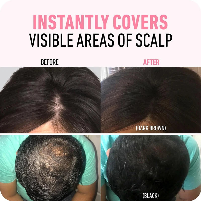 Fluffy Hairline Powder Concealer Temporary Hair Fibers black Hair Root Cover Up Gray Coverage Hairline Shadow Powder Instantly Zpaxo