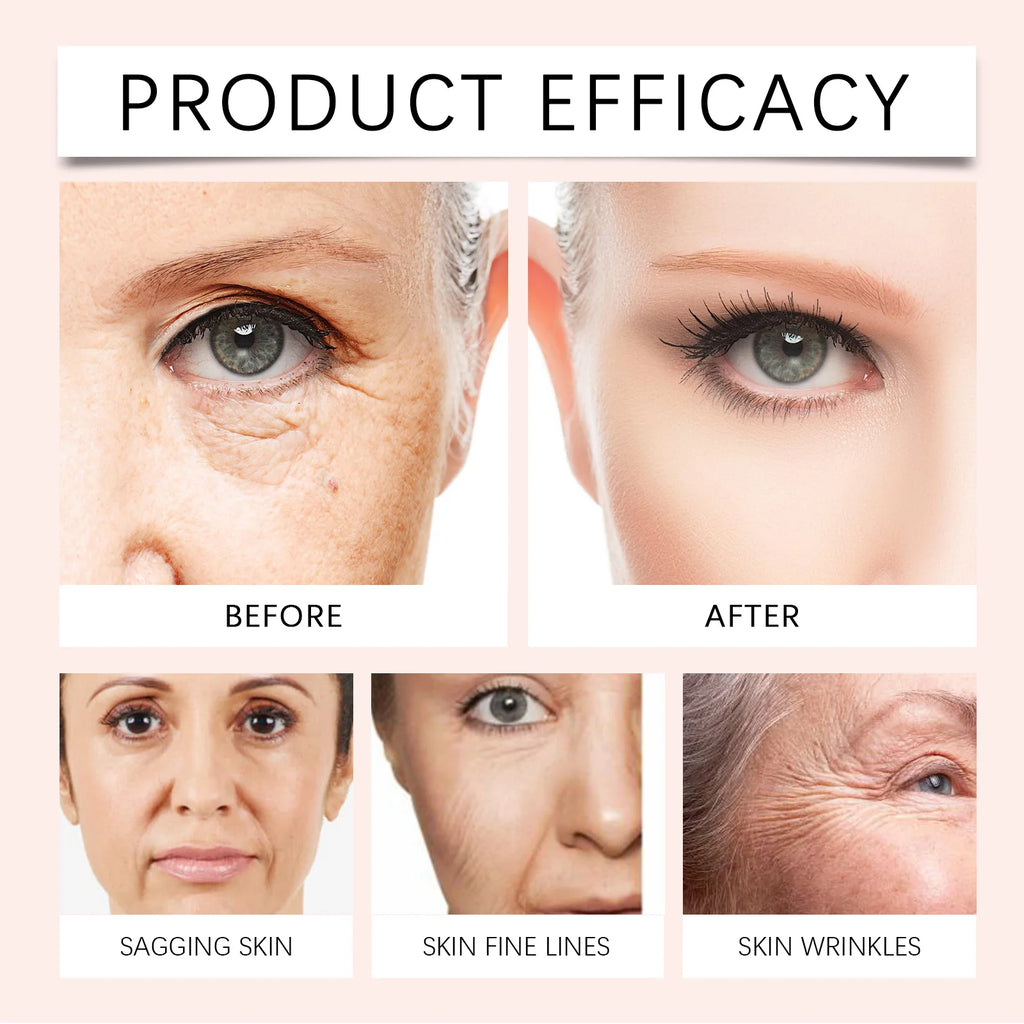 Hoygi Anti-Aging Wrinkle Cream with Skin Tightening Face Moisturizer Clinically Proven for All Skin Types Sensitive Dry Oily Zpaxo