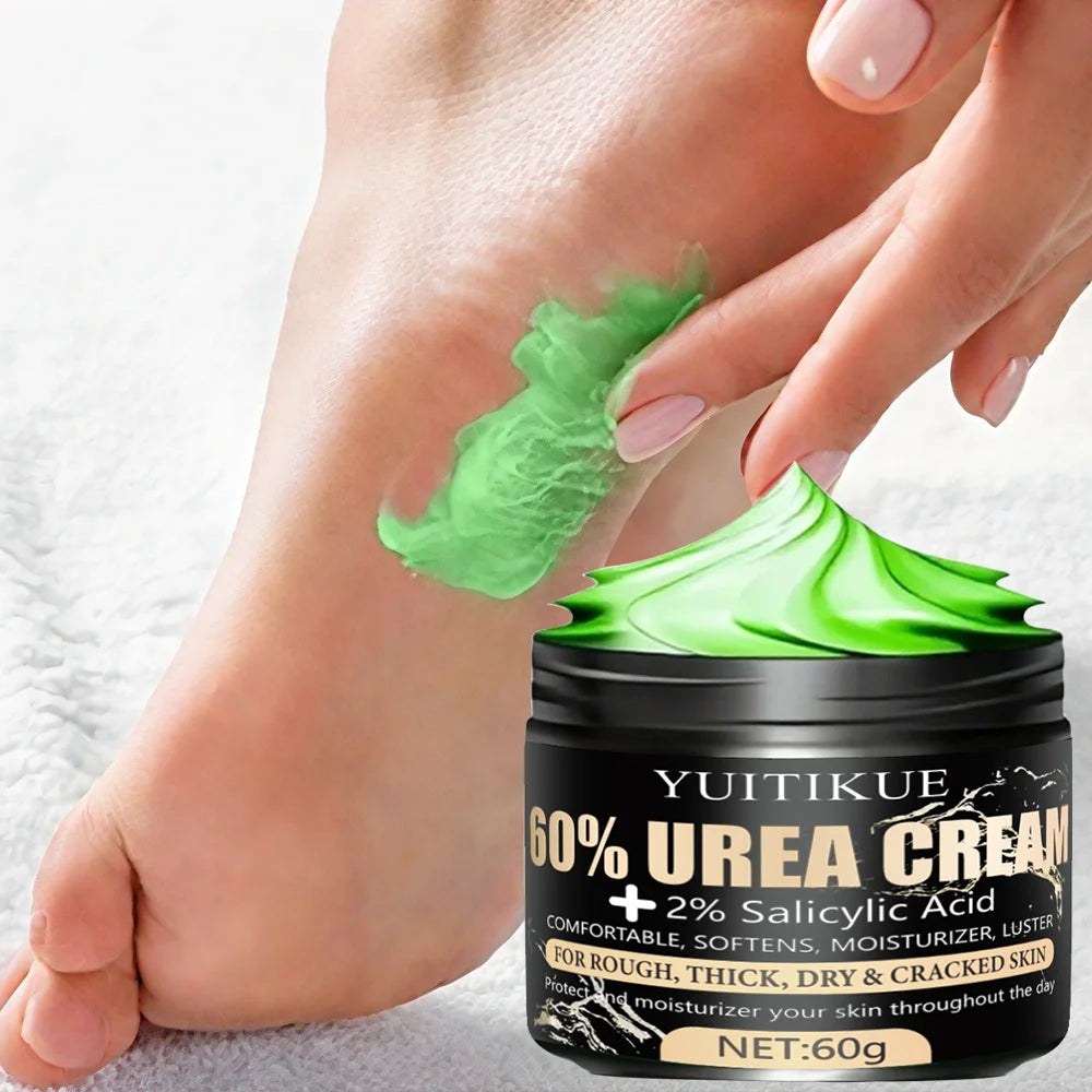 Urea Cream 60g – Cracked Heels, Dry Hands & Rough Skin Repair Foot & Skin Cream Zpaxo