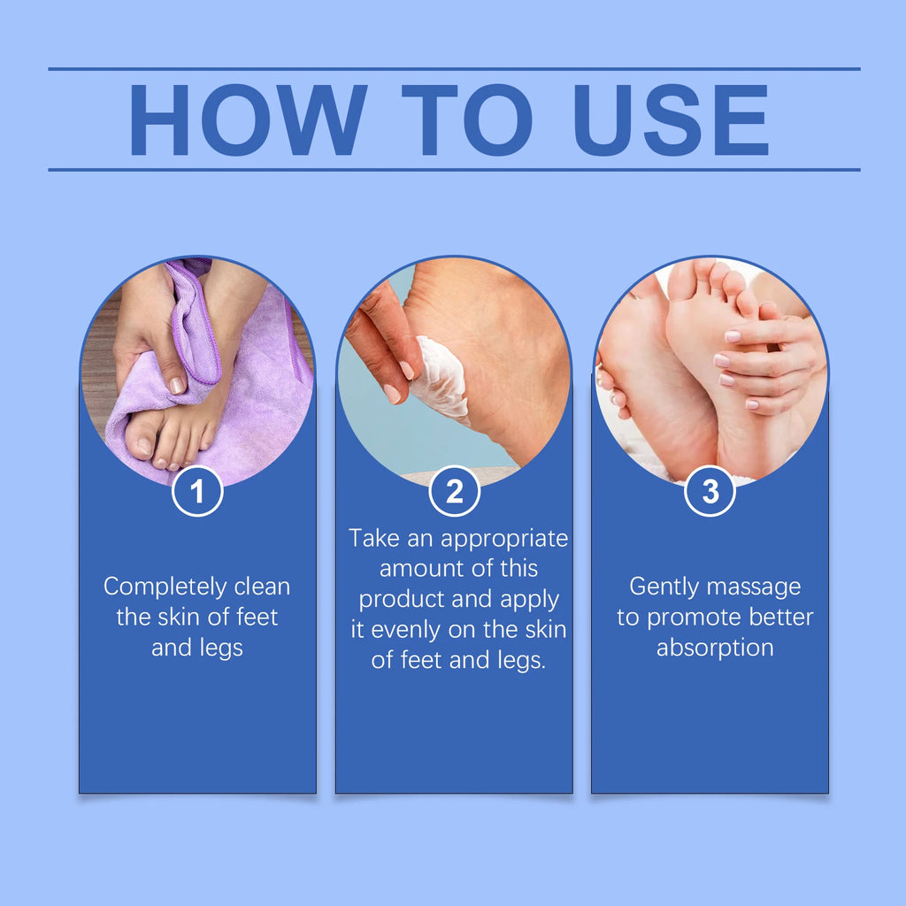 OceAura 60% Urea Foot Cream – Cracked Heel & Callus Repair Urea Foot Cream Zpaxo
