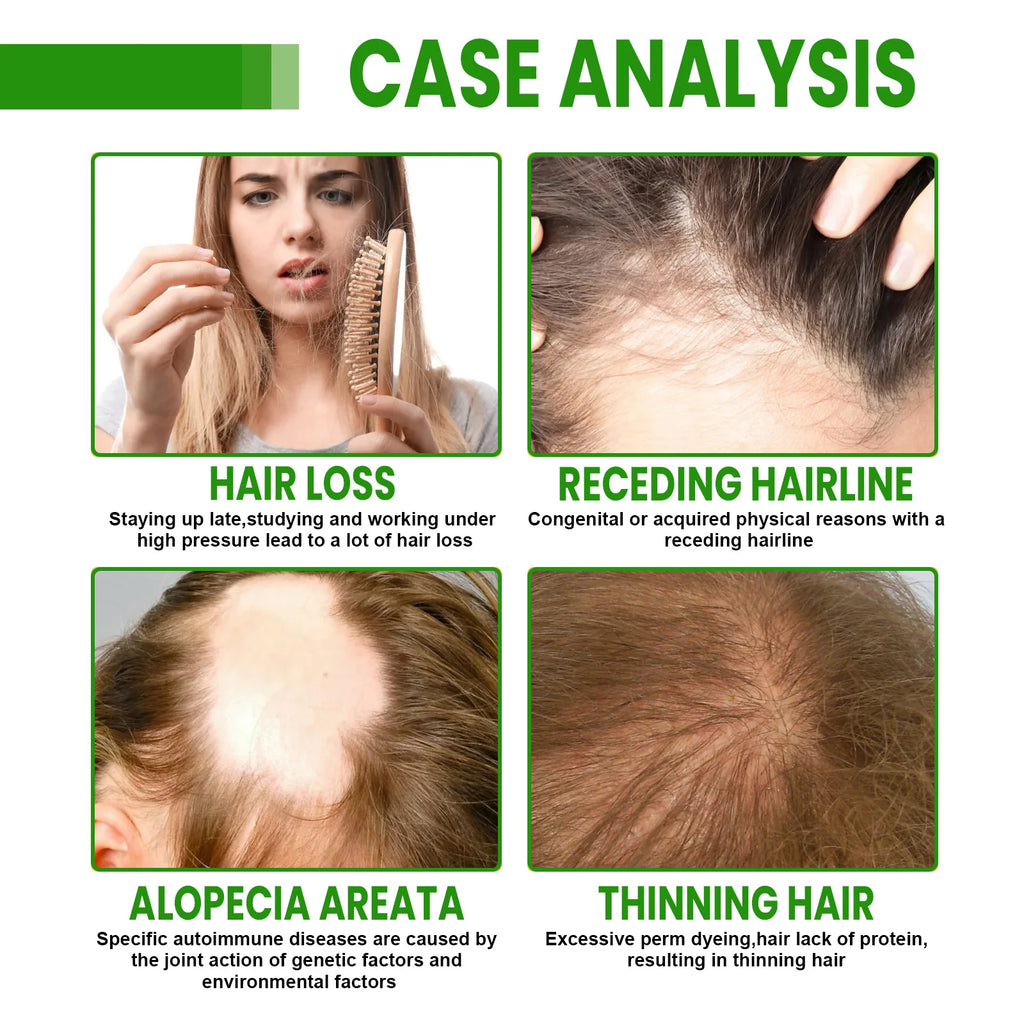 Rosemary Hair Growth Spray - Helps Strengthen Roots, Reduce Hair Loss, Nourish Dry Damaged Hair, Natural Essential Oil Treatment Zpaxo