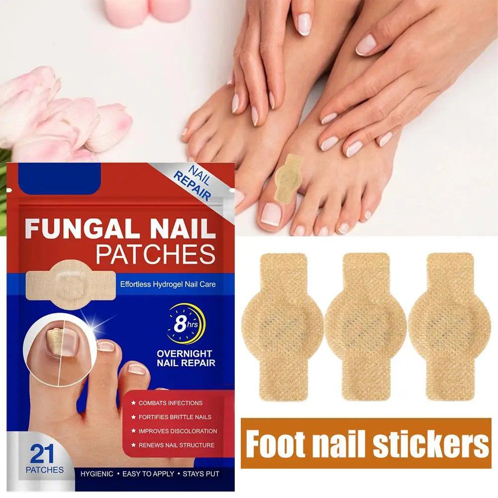Foot Nail Repair Patches Nail Ingrown Correction Sticker Antifungals Toenail-Fungus Treatments Stickers Damaged Nail Care Tool Zpaxo