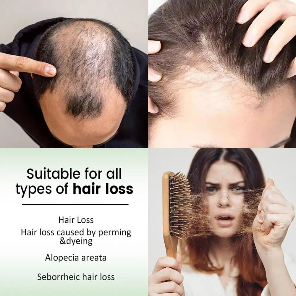 Rosemary Shampoo – Volumizing, Thickening & Oil Control Rosemary Hair Shampoo Zpaxo