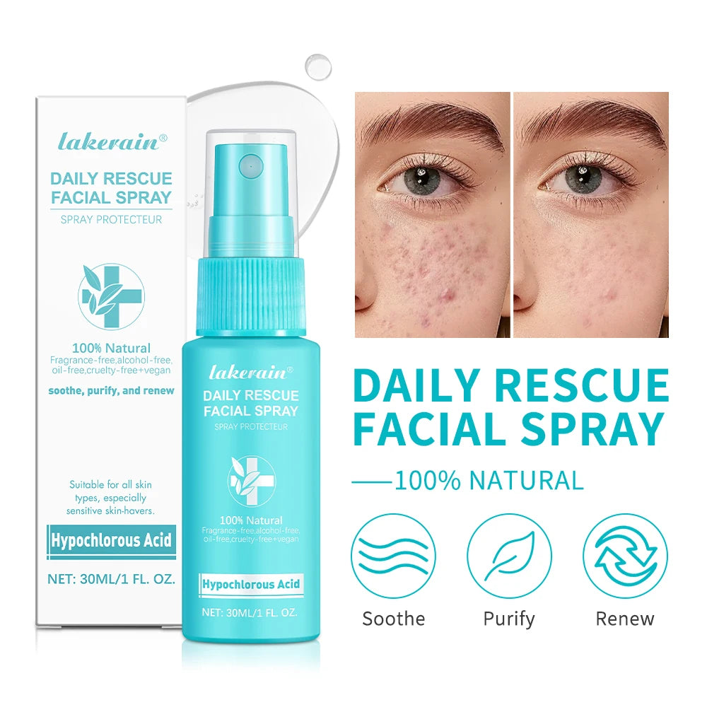 Hypochlorous Acid Facial Spray – Soothing Toner Sensitive Skin Facial Toner Spray Zpaxo Default Title