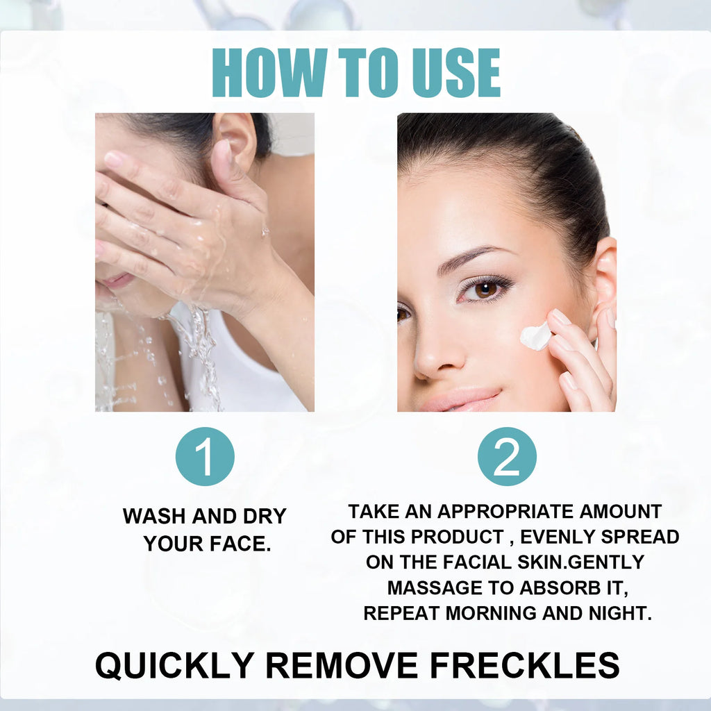 Freckle Whitening Cream Nicotinamide Fade Dark Spot Blemish Acne Mark Brightening Lightening Pigmentation Correction Cream Zpaxo