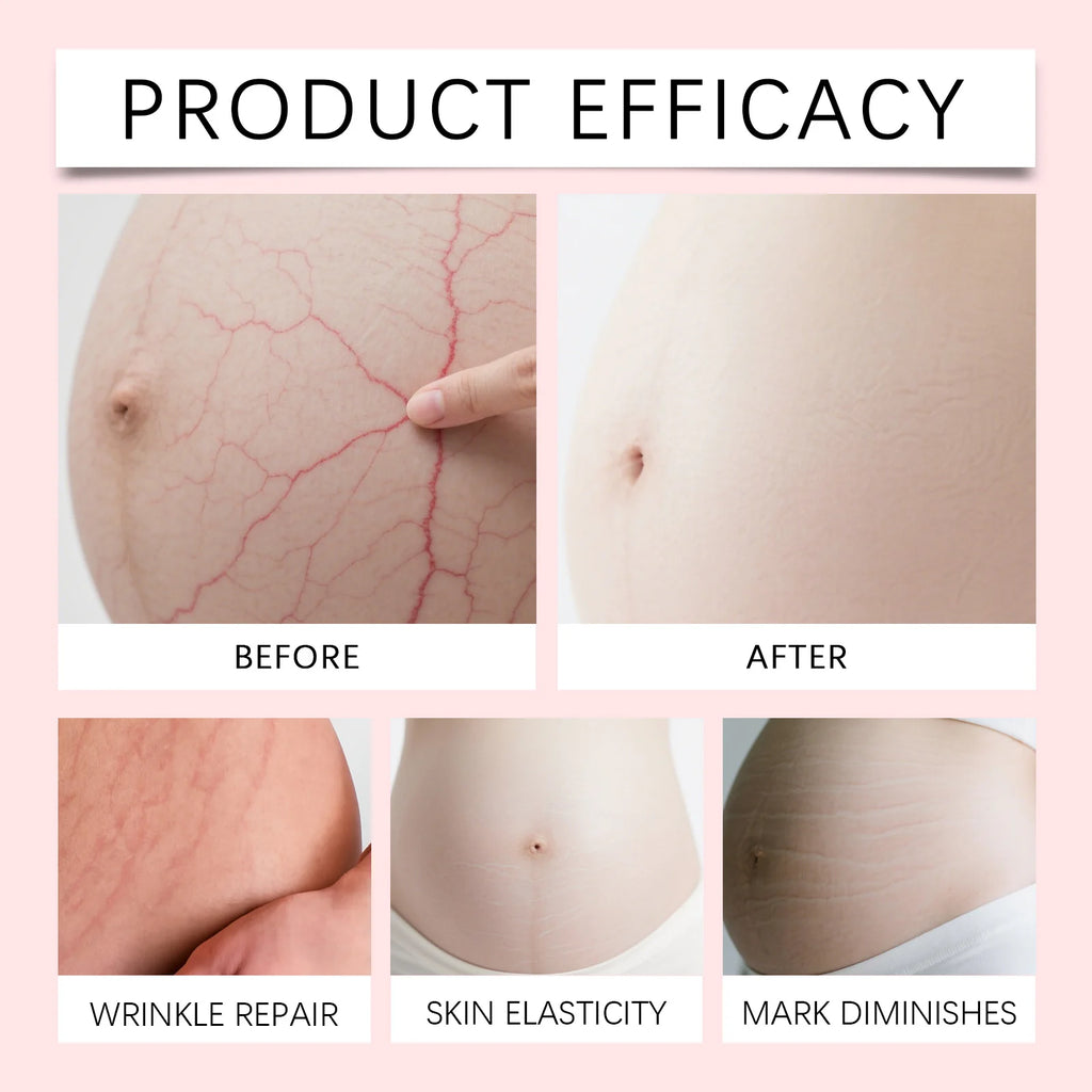 Pregnancy Stretch Mark Cream Hydrating Body Moisturizer for Belly Skin Winter Skincare Gift Set Holiday Maternity Care Present Zpaxo