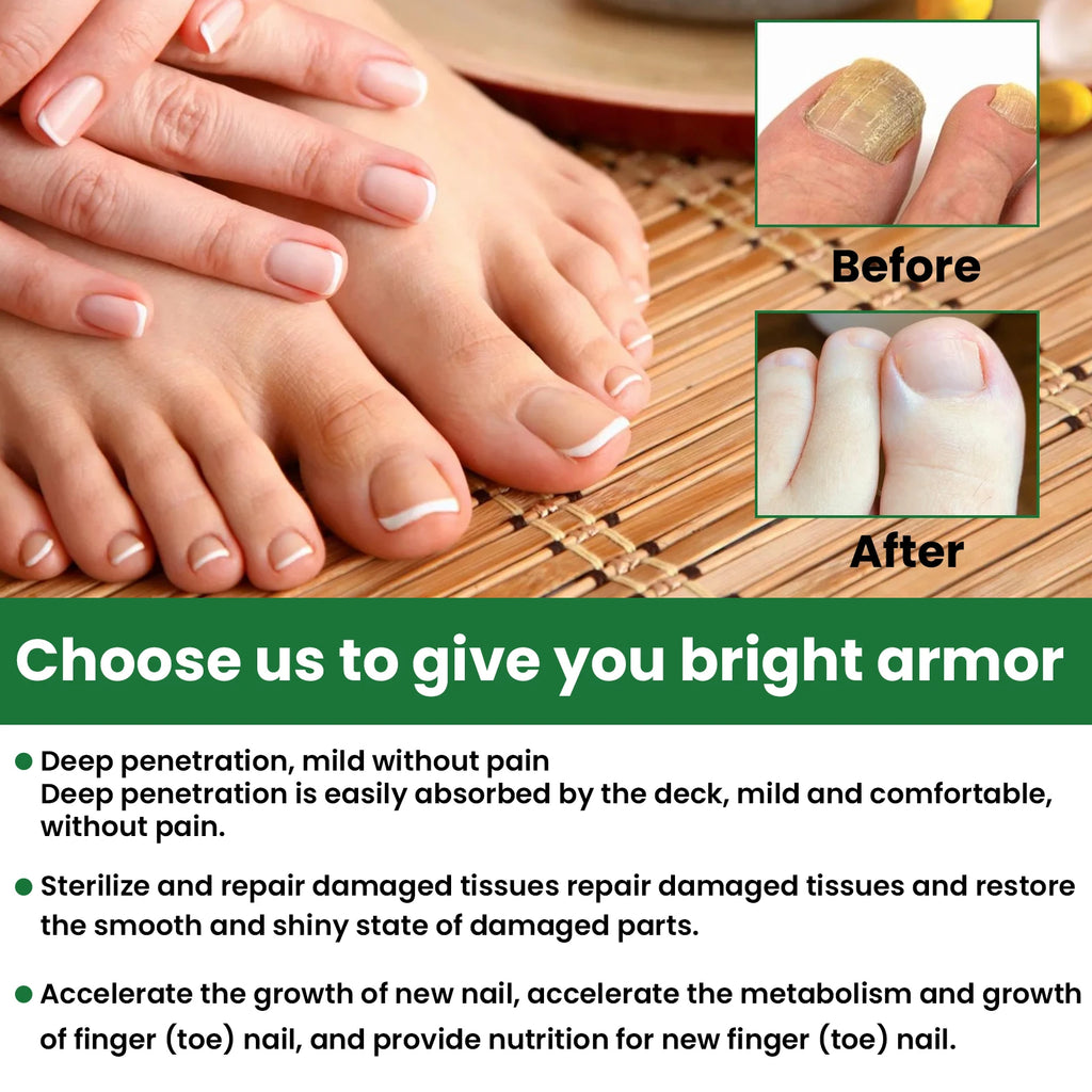 Nail Repair & Strengthening LiquidRepairs and nourishes nails, brightens, moisturizes and protects, for hand & foot nail care. Zpaxo
