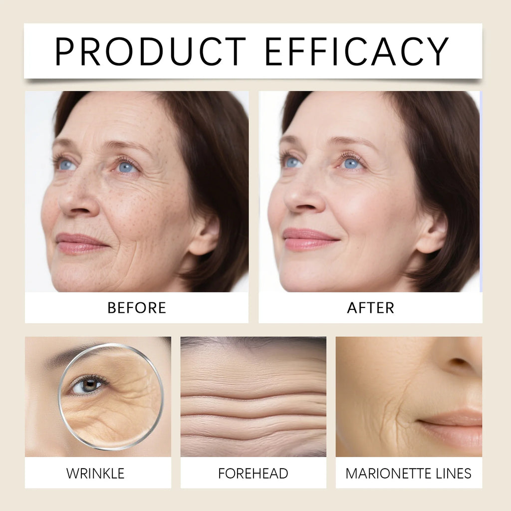 Retinol Moisturizer Cream Anti Wrinkle Hydrating Winter Skincare Deep Hydration Lock Gentle Nourishing Lasting Moisturization Zpaxo