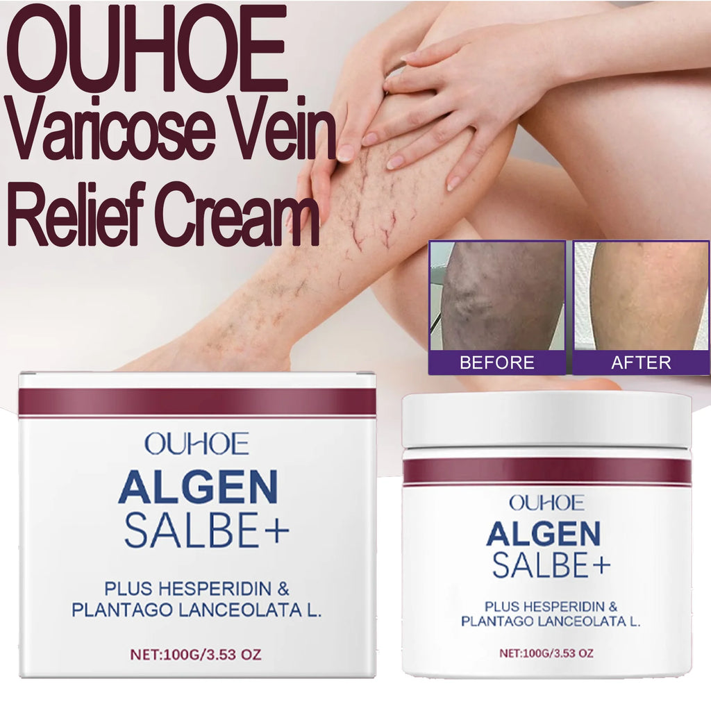 OUHOE Algen Salbe Varicose Vein Relief Cream Improve Venous Tension Accelerate Blood Circulation Deeply Moisturize The Skin Zpaxo