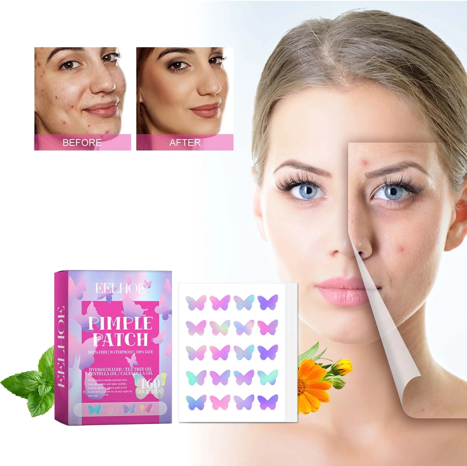 Pimple Patches for Face Cute Butterfly Shaped Acne Patches Hydrocolloid Cute Zit Stickers Parches Para Acne Zpaxo
