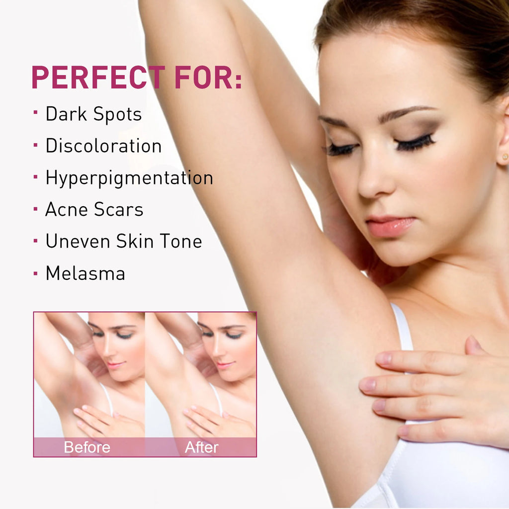 Eelhoe Skin Lightening Cream – Underarm & Body Brightener 60ml Skin Brightening Cream Zpaxo