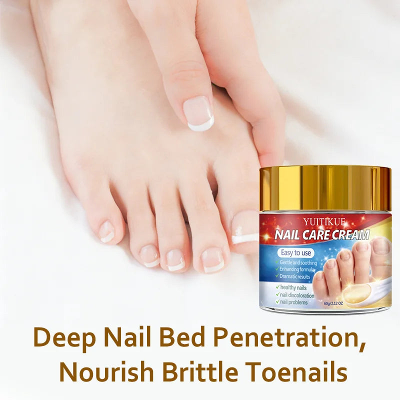 YUITIKUE Nail Repair Cream – Retinol & Collagen Formula 60g Nail Repair Cream Zpaxo