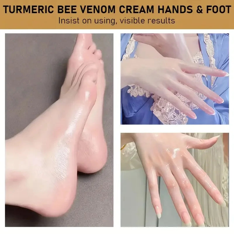 YUITIKUE Lanolin Hand & Foot Cream 50g – 3-in-1 Dry Skin Repair Hand & Foot Cream Zpaxo