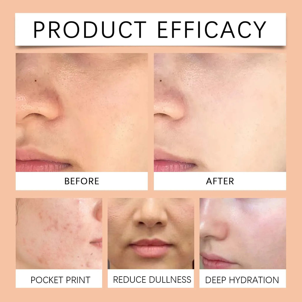 Vitamin C Brightening Toner for Face with Niacinamide Hydrating Facial Toner Dry Sensitive Skin Smooth Radiant Complexion 100ml Zpaxo