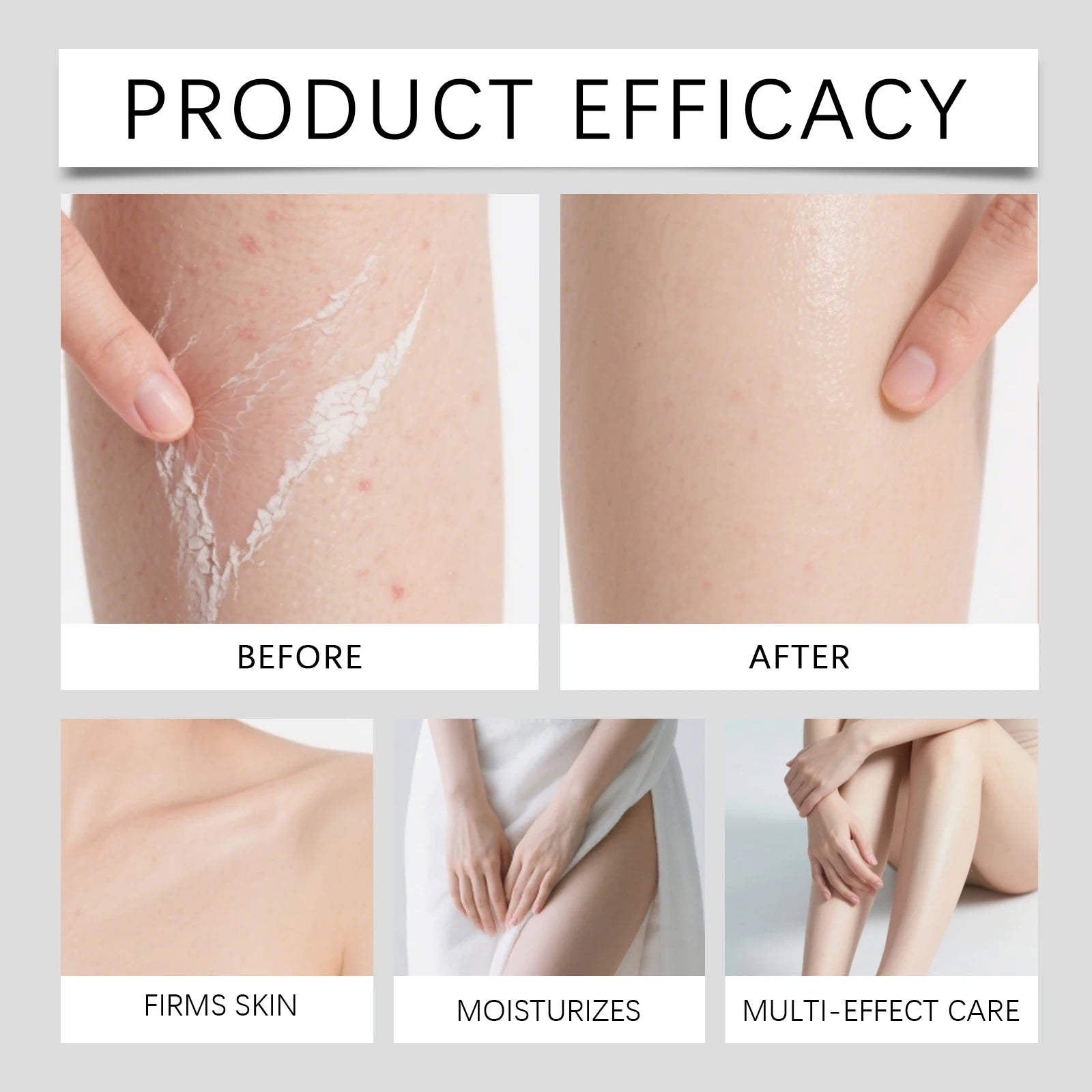 Easy Spray On Body Exfoliator Kojic Acid Turmeric Formula for Dark Elbows Improves Skin Texture & Dullness Rinse Off Gentle Peel Zpaxo