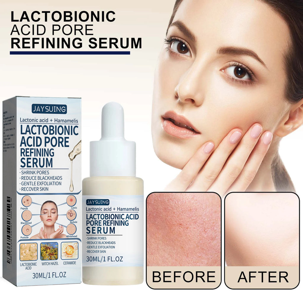 Lactic Acid Essence Removes Blackheads Tightens Pores Deep Cleansing Exfoliation Gently Moisturizes Skin Zpaxo