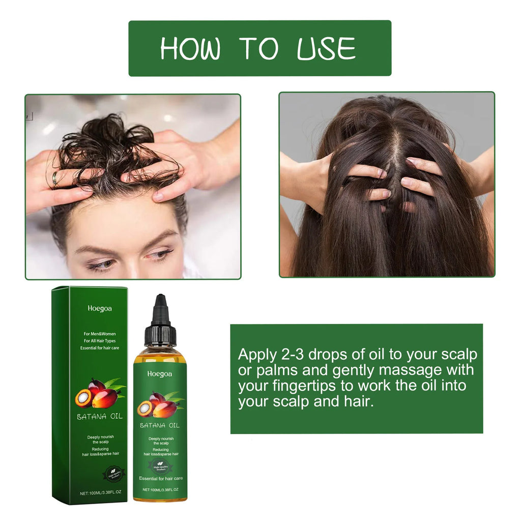 Hair Growth Oil Nourishing Scalp Repairing Strengthening Preventing Hair Loss Dry Damaged Frizz Control Men Women Hair Products Zpaxo