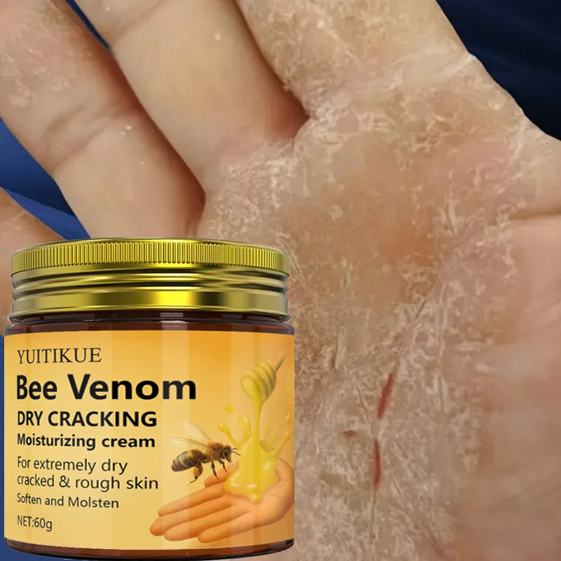 YUITIKUE Bee Venom Repair Cream 60g – Cracked Skin Treatment Skin Repair Cream Zpaxo