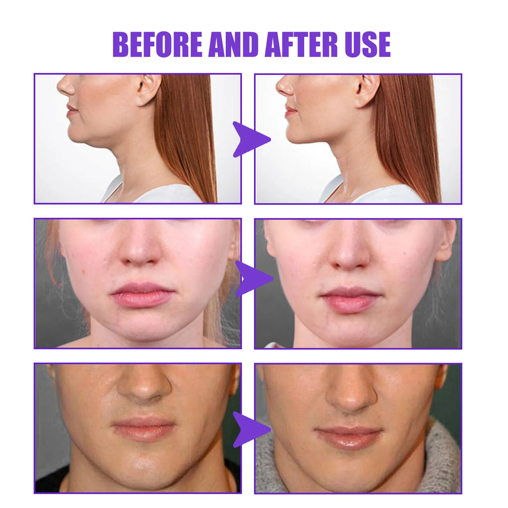 Jaysuing V-Shape Face Firming & Slimming Cream 30g Face Firming Cream Zpaxo