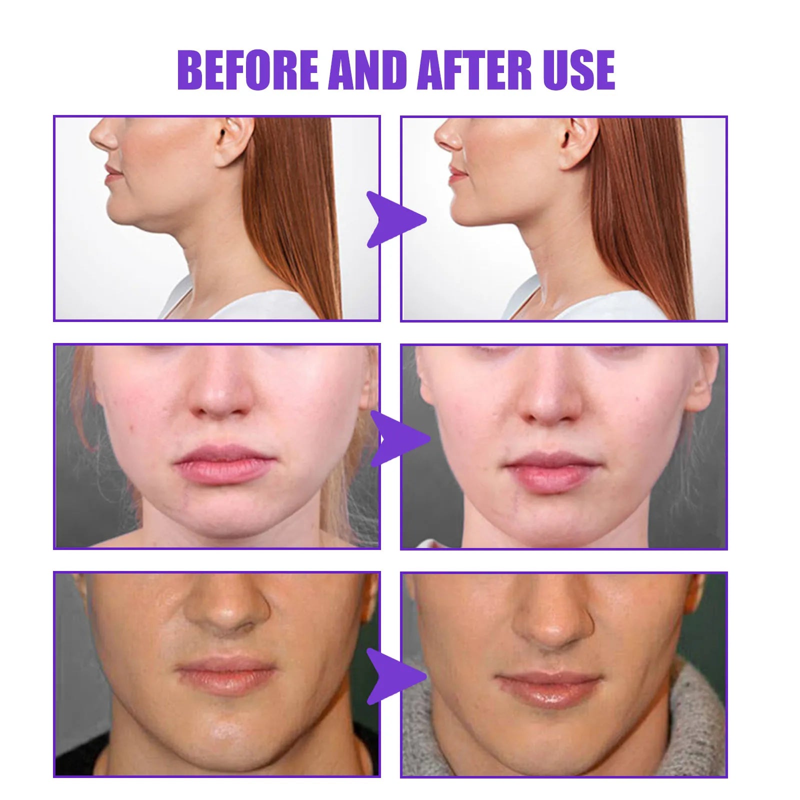 Jaysuing V-Shape Face Firming & Slimming Cream 30g Face Firming Cream Zpaxo