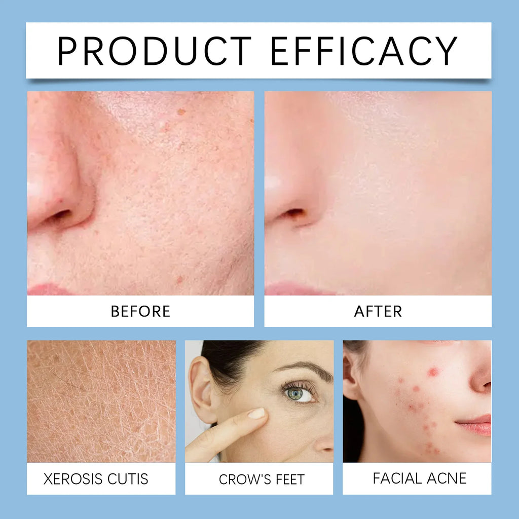 Hoygi Salicylic Acid Exfoliating Pads for Face 70pcs Gentle Skin Brightening Toner Wipes with Glycolic Acid for Smooth Texture Zpaxo