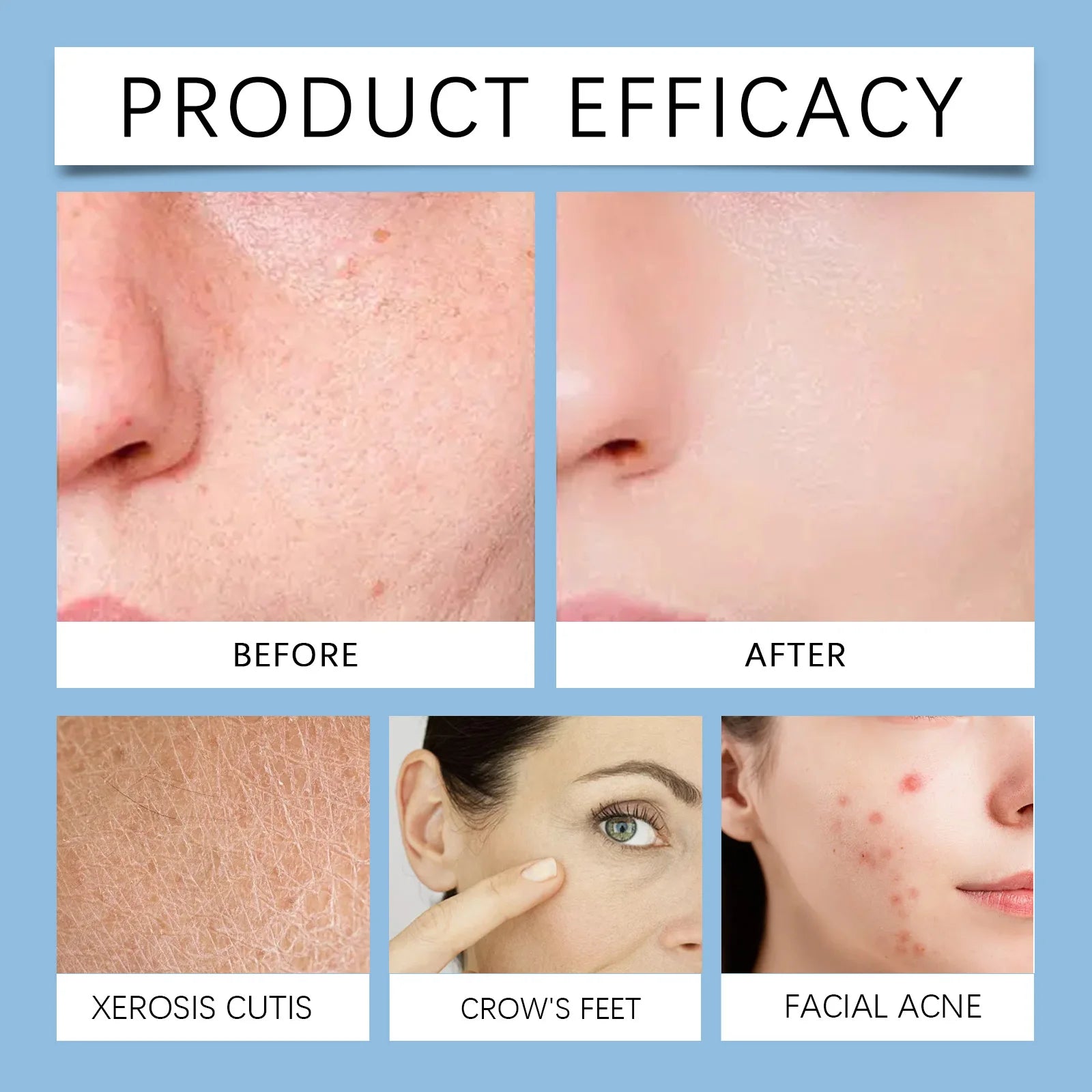 Hoygi Salicylic Acid Exfoliating Pads for Face 70pcs Gentle Skin Brightening Toner Wipes with Glycolic Acid for Smooth Texture Zpaxo