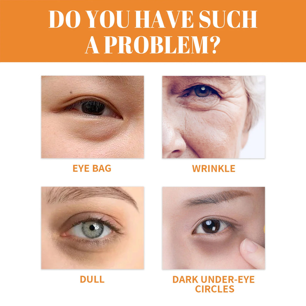 Collagen Eye Masks – Dark Circles, Bags & Anti-Wrinkle Patches Eye Care Patches Zpaxo