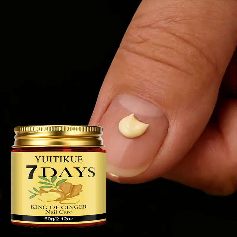 YUITIKUE 7-Day Ginger King Nail Care Cream – Renew Nails 60g Nail Treatment Cream Zpaxo Default Title