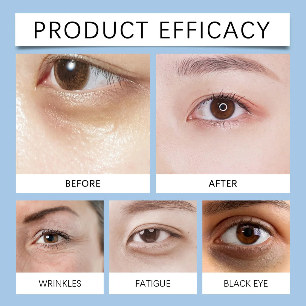 Hydrating Eye Cream for Dark Circles and Puffiness Gentle Moisturizing Formula Reduces Fine Lines 15ml Sensitive Skin Friendly Zpaxo