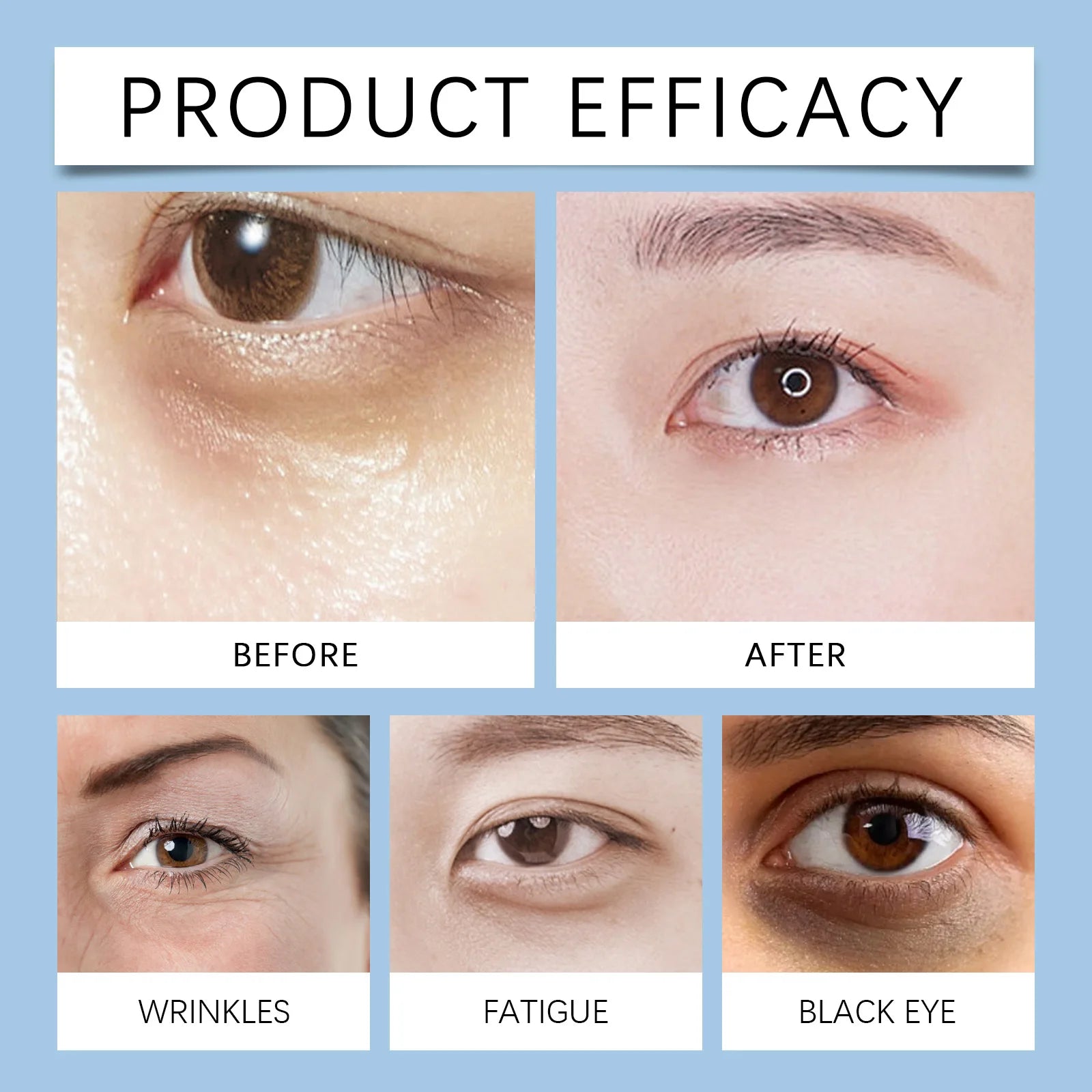 Hydrating Eye Cream for Dark Circles and Puffiness Gentle Moisturizing Formula Reduces Fine Lines 15ml Sensitive Skin Friendly Zpaxo