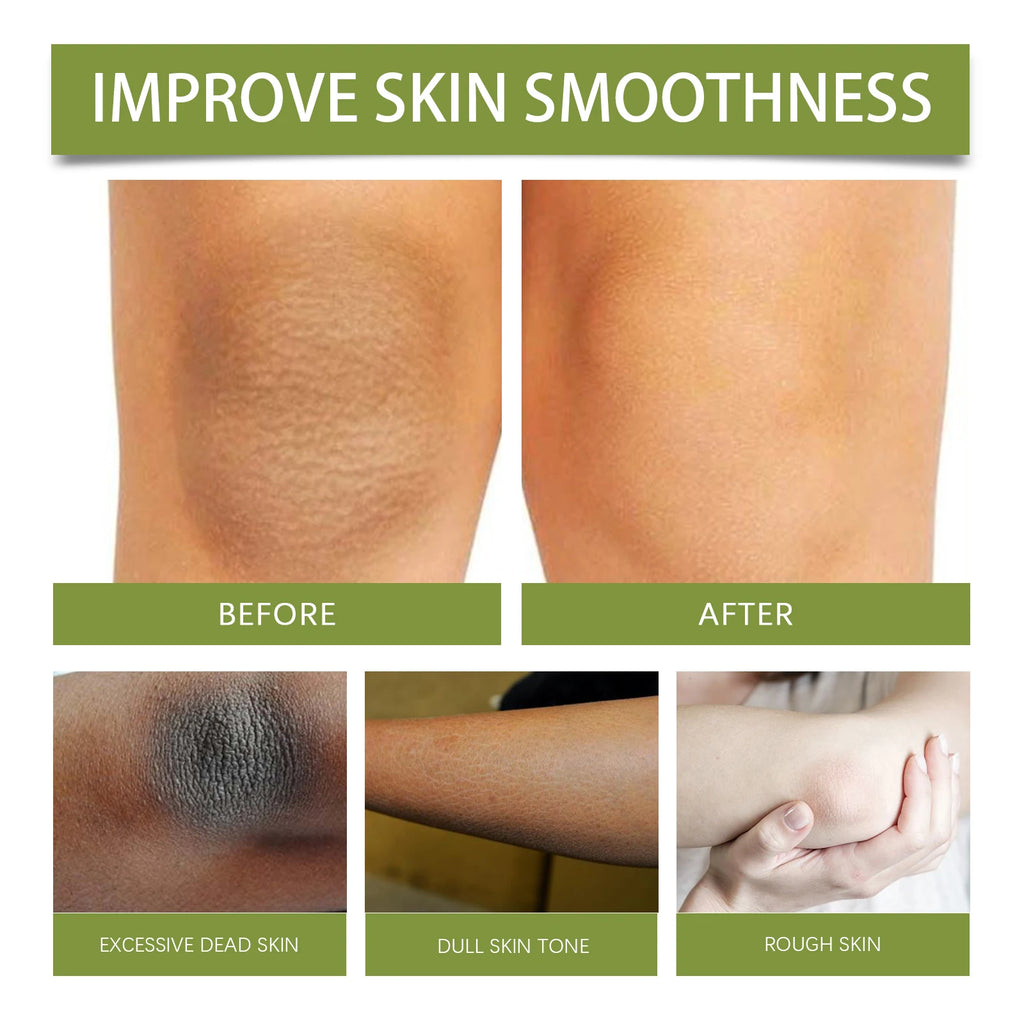 EELHOE Green Fig Sugar Scrub Gentle Exfoliation Smooth Skin Deeply Moisturize Improve Skin Elasticity Fresh Fruity Aroma 120g Zpaxo