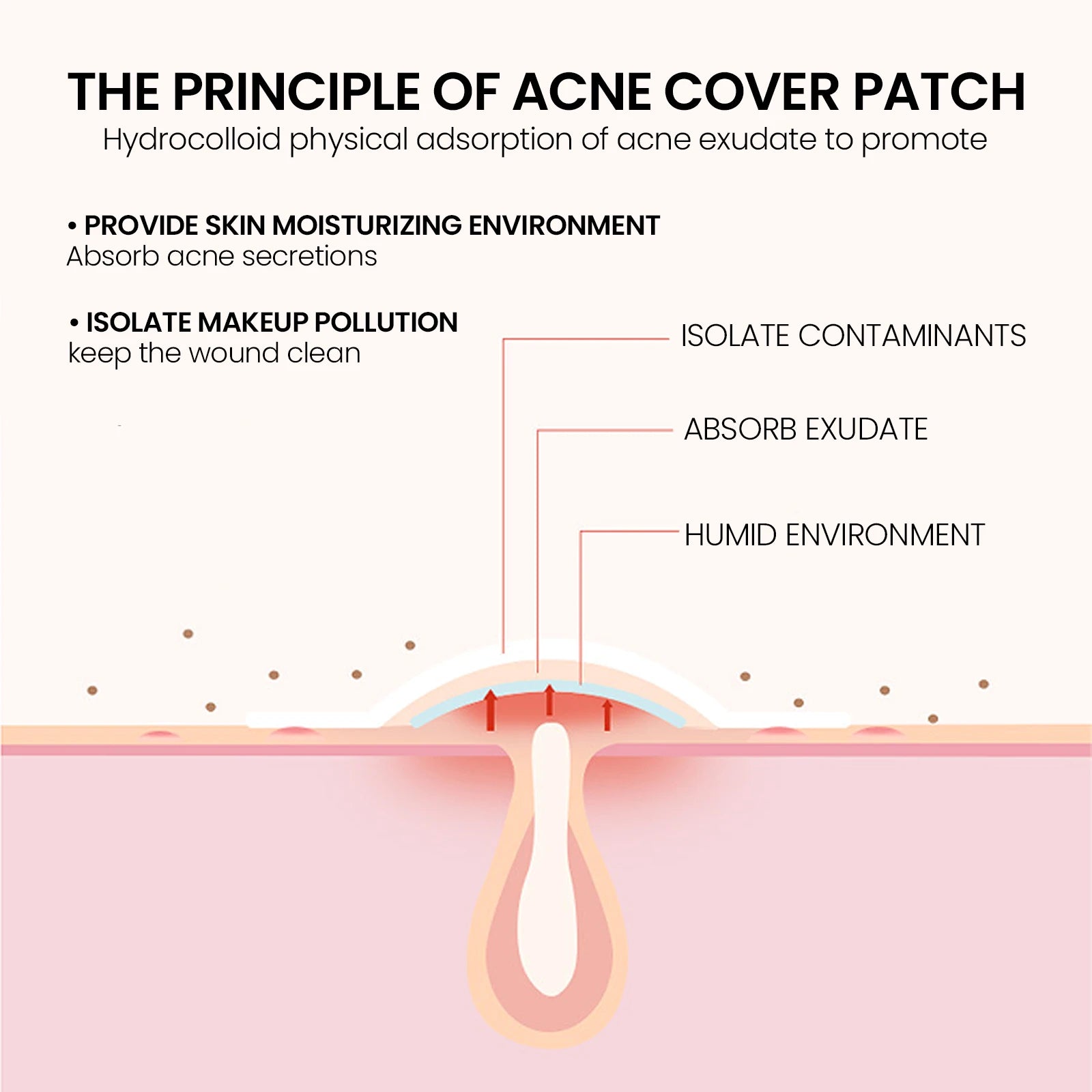 200Pcs Repair Acne Patch Fade Blemishes Pimple Marks Closed Acne Blemishes Hydrocolloid Star Shaped Cover Acne Pimple Patch Zpaxo