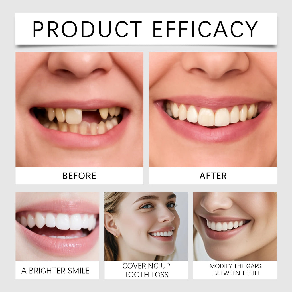 Snap On Dentures Smile Veneers Instant Smile Temporary Teeth Missing Teeth Cover Adjustable Perfect Smile Fake Teeth Resin Zpaxo