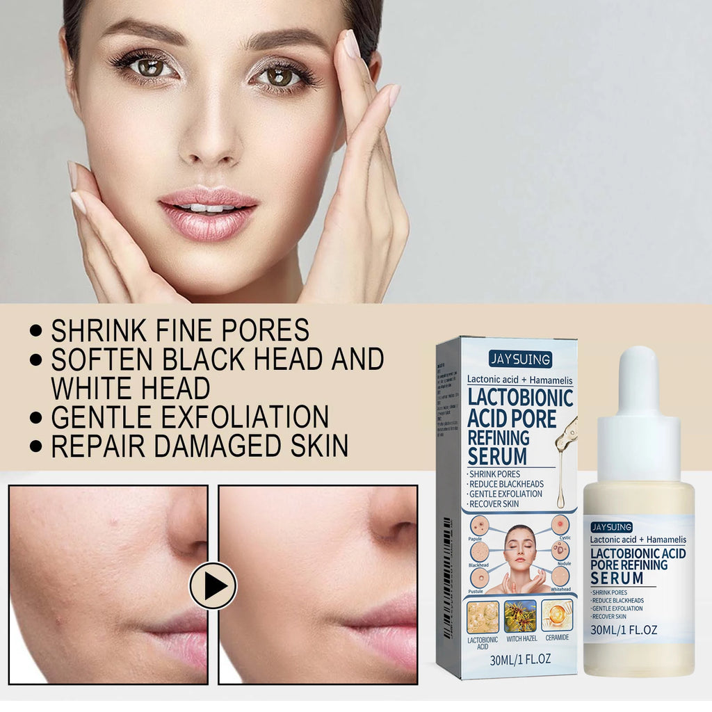 Lactic Acid Essence Removes Blackheads Tightens Pores Deep Cleansing Exfoliation Gently Moisturizes Skin Zpaxo