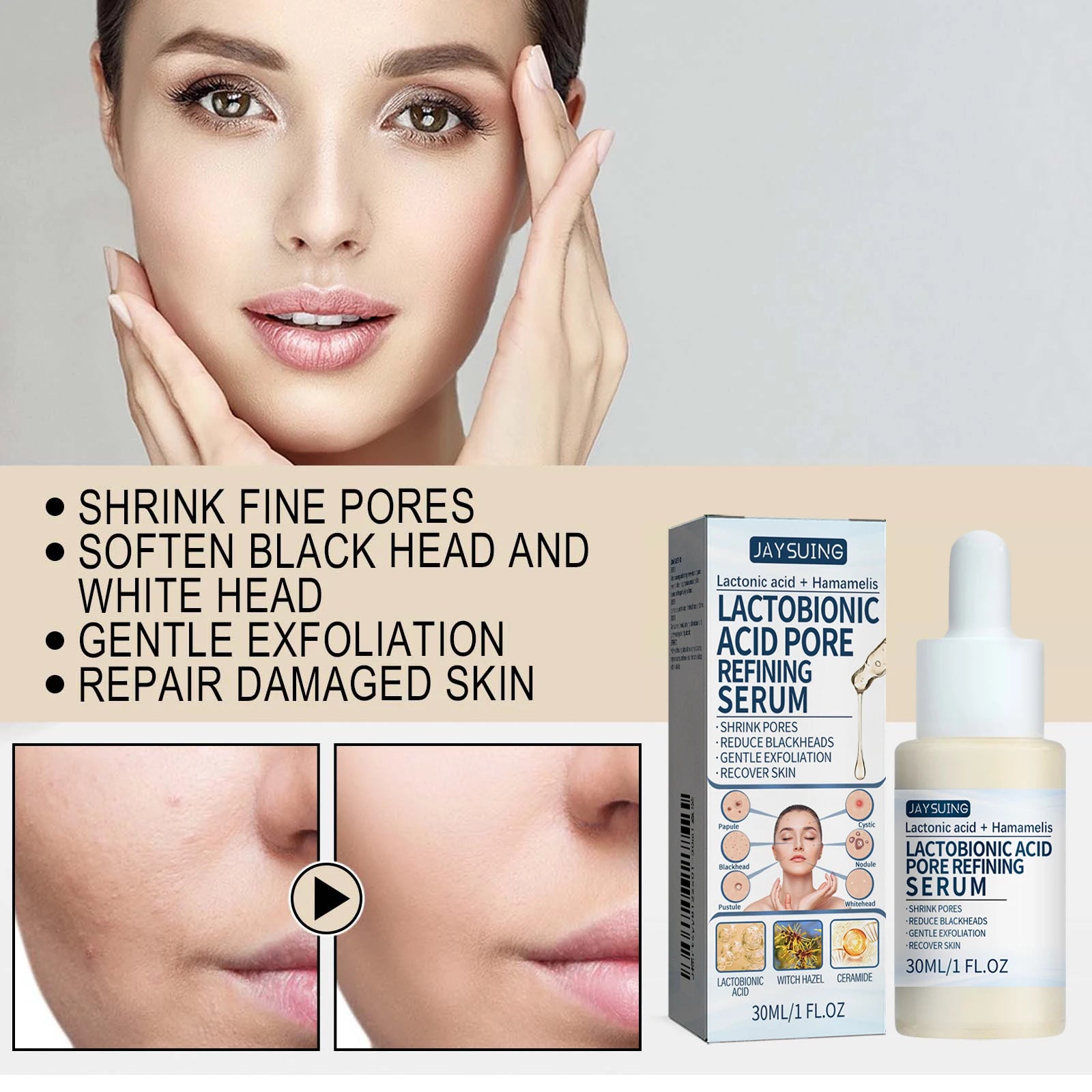 Lactic Acid Essence Removes Blackheads Tightens Pores Deep Cleansing Exfoliation Gently Moisturizes Skin Zpaxo