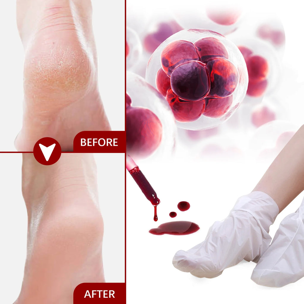 AHA Exfoliating Foot Mask Moisturizing Anti Crack Heel Foot Calluses Dead Skin Remover Smooth & Soft Feet Care Foot Patch Zpaxo