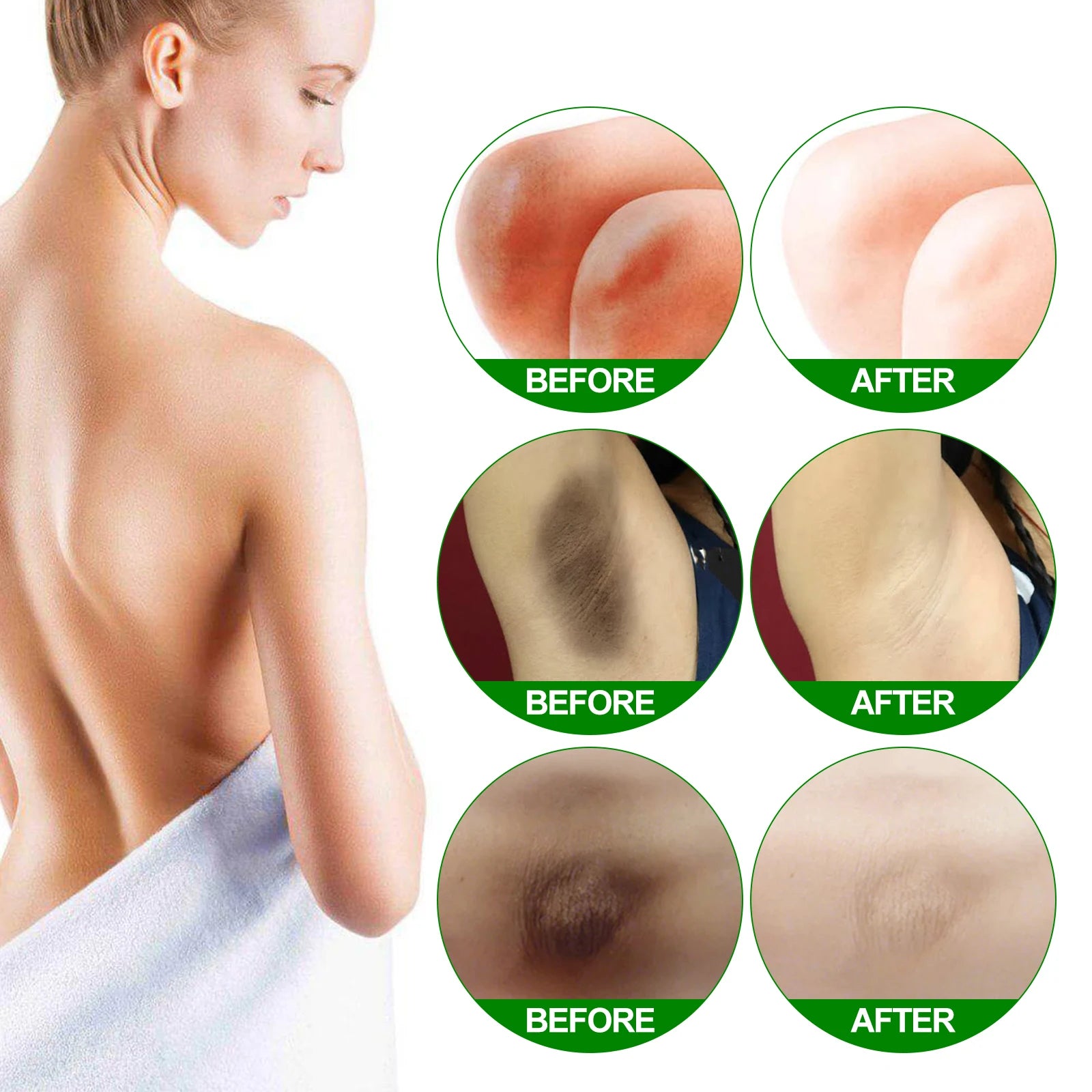 Eelhoe Retinol Brightening Cream – Dark Knees, Underarms & Body Skin Brightening Cream Zpaxo