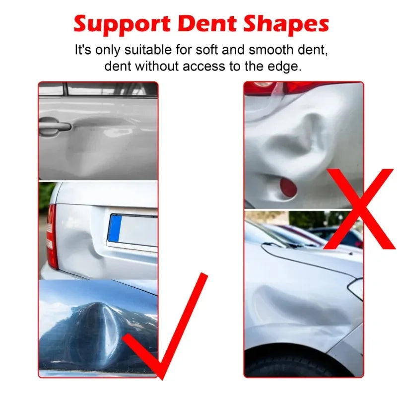 WOYO PDR100 Slide Hammer Dent Puller Kit – Paintless Dent Repair