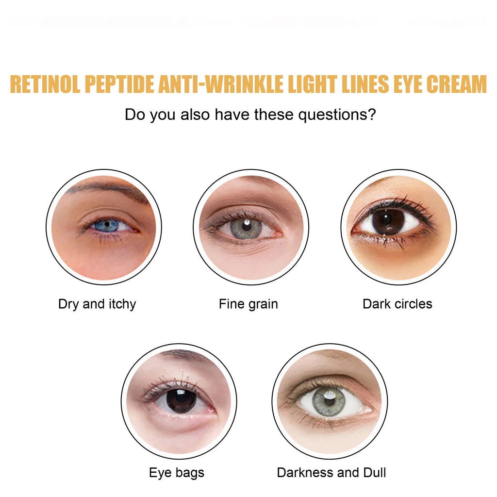 Retinol Peptide Eye Cream – Dark Circles & Puffiness Relief Eye Cream Zpaxo
